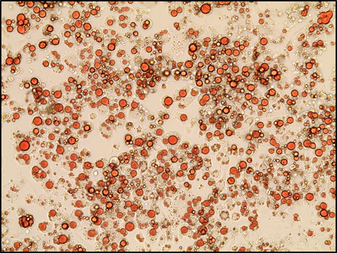 Oil Red O staining of 3T3-L1 cells