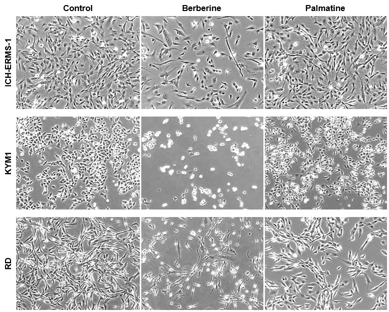 ベルベリン類による横紋筋肉腫の増殖阻害 (２次元) / Berberine analogs inhibit growth of RMS cells (2D)