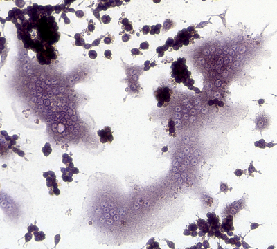 TRAP staining of RAW264.7 cells