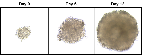 横紋筋肉腫細胞の３次元培養 / 3D culture of RMS cells